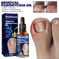 Minyak Relief Paronychia Anti Fungal Kuku Kaki Serum Anti Paronychia Ingrown Toenail Corrector Essen