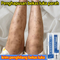 Penghilang Bekas Luka Bekas Luka Hitam Di Kaki Penghilang Bekas Luka Hitam Koreng Penghilang Bekas J