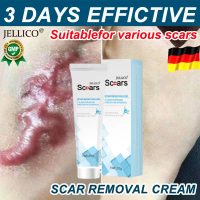 7-day Scar Removal Scar Removal Cream Keloid Scar Remover Remove Stretch Marks Burns Scald Repair Ac