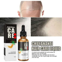 Sdotter New Anti hair loss and hair growth liquid spray special certificate ginger about ginger hair growth liquid