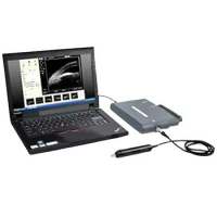MD-320W Portable Ophthalmic Ultrasound Biomicroscope with a Notebook