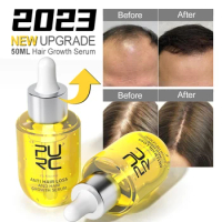 PURC Hair Growth Products for Men Women Ginger Hair Growth Serum ANTI Hair Loss Treatment Hair oil Care powerful tonic 50ml NEW
