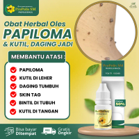 Propolis SM Perawatan Kutil Papiloma, Daging Tumbuh / Skin Tag, Punggung Berjerawat, Kutil Hitam di