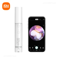 Xiaomi SUNUO Intelligent Visual Ultrasonic Dental Impactor Waterproof Home Electric Tooth Calculus Remover Teeth Plaque Cleaner