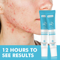 Kem Trị Mụn Axit Salicylic, Mua 1 Tặng 1, Làm Mờ Sẹo Mụn, Loại Bỏ Mụn Đầu Đen Và Mụn Đầu Trắng, Thu 