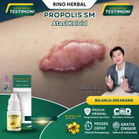 Keloid Herbal, Keloid Penghilang Bekas Luka, Benjolan Menahun, Daging Tumbuh, Penghilang Daging Tumb