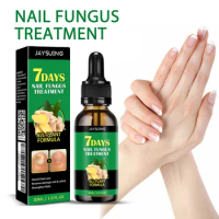 7DAYS Repair Nail Fungus Treatments Essence Foot Care Serum Toe Nails Fungal Removal Gel Anti-Infection Onychomycosis Care Tool