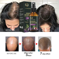 Rosemary and Onion and Black Rice Extract Hair Growth Spray Hair Growth Oil for Hair Repair Treatment Growth Products