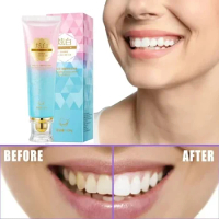 100g White Toothpaste Fresh Breath Niacinamide Toothpaste To Remove Bad Breath To Remove Tooth Stains Teeth Tone Care