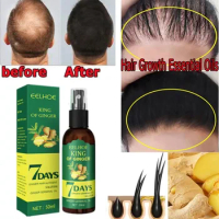 Ginger Hair Growth Spray Strengthening Hair Massage Scalp Dense Hair Strengthening Hair Loss Prevention Repair Nourishing Liquid