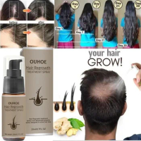 Hair Growth Serum Spray Ginger Anti Hair Loss Treatment Products Repair Nourish hair Roots Fast Regrowth Men Women