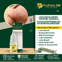 Propolis SM Obat Untuk Luka Borok Bernanah, Luka Infeksi, Ruam Kulit Kemerahan, Borok Di tangan dan 