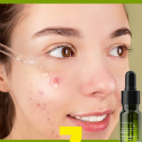 Acne Treatment Face Cream Salicylic Acid Acne Scar Pimple Remover Oil Control Whitening Smoothing Facial Skin Care