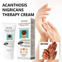 EELHOE Acanthosis Nigricans Therapy Cream Cream for Underarm Arm Knee Joint Black Moisturizing and Whitening Body Care Cream