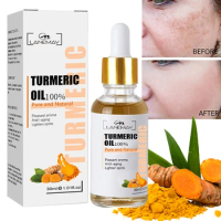 Turmeric Freckle Whitening Serum Fade Dark Spot Removal Pigment Melanin Correcting Facial Serum Beauty Face Skin Care 30ml