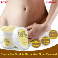 50g Stretch Mark Repair Cream Postpartum Pregnant Women Scar Repair