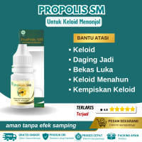 Propolis Sm Salep Untuk Keloid Menonjol Daging Jadi Bekas Luka Keloid Berkerut Keloid Menahun