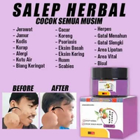 COD SALEP GATAL PALING AMPUH SALAP PANU SALAP SELANGKANGAN ORIGINAL 30G SALEP GATAL UNGGU