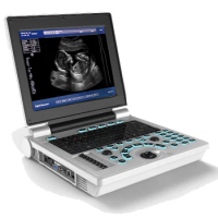 Cheapest And Affordable Full Digital Black And White Notebook/Laptop 12 Inches Veterinary Ultrasound Scanner Factory Price