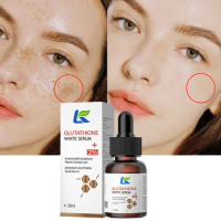 Freckle Whitening Serum Fade Dark Spot Removal Pigment Melanin Correcting Facial Essence Beauty Face Skin Care