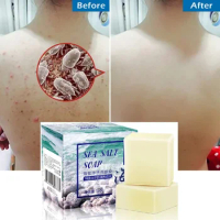 Removal Pimple Pores Acne Treatment Sea Salt Soap Cleaner Goat Milk Moisturizing Face Care Wash Basis for Skin Care Whitening