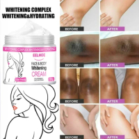 Eelhoe Body Whitening Cream Underarm Armpit Knee Dark Skin Whitening Bleaching Cream Moisturizing Brighten Body Lotion