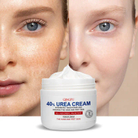 Kem Dưỡng Ẩm VE Urea, QINGPU, nồng độ Urea 40%, 150g, Dưỡng Ẩm Chuyên Sâu, Thích Hợp Sử Dụng Trên Kh