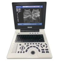 High Quality Convex Probe Ultrasound Phased Array Flaw Detector Powerful 4d Function Notebook LED Digital Ultrasound
