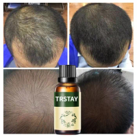 Hair Shampoo Oil and Conditioner Hair Growth and Hair Loss Prevents Premature Thinning Hair for Men and Women