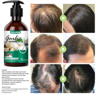 100ml Garlic Hair Growth Shampoo Anti Hair Loss Hair Shampoo Cool Loss Growth Treatment Growth Serum Effective