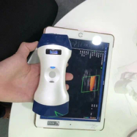 OEM 2 in 1 Wifi dual head color ultrasound probe scanner wireless suitable for iPad, iPhone, Android