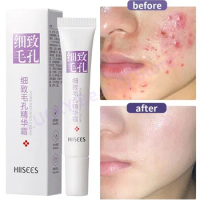 Salicylic Acid Pore Shrinking Cream Quick Elimination Large Pores Remove Blackehead Tighten Face Smooth Skin Korean Care Product
