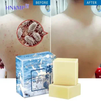 60g Sea Salt Soap Remover Opens Pores Goat Milk Whitening Soap Facial Cleaner Pimple Acne