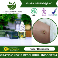 Pusar Bernanah, Berair, Udel Berdarah, Gatal Dan Hitam, Luka Di Kulit Pusar Aman Untuk Anak Bayi Ibu