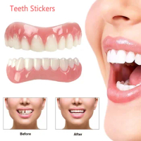 9 Styles Extra Thin Snap-On Fake Bright White Tooth Veneers Silicone Soft Safe Smile Adhesive Denture Hide Shade Braces