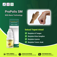 Propolis SM - Obat Benjolan di Tangan, Kista Ganglion, Benjolan Lipoma, Benjolan Kelenjar Getah Beni