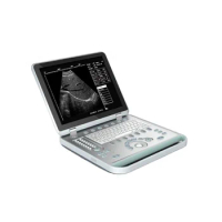 3d Laptop Hospital Equipment Ultrasound Abdominal Scan Machine 12inch Led Full Digital Portable Ultrasound Scan Machine