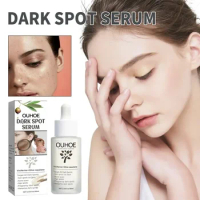 Dark Spot Acne Essence fade Spots Moisturizes Anti-freckle Skin Repair Acne Prints Facial Dull Brightening whitening serum care