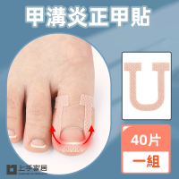 【上手家居】甲溝炎正甲貼 40貼組(凍甲/嵌甲/卷甲/嵌甲貼片/腳趾甲貼片)