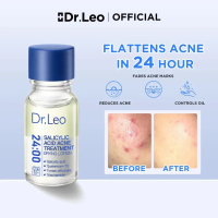 ใHOTใDr. Leo Acne Remover Serum Salicylic Acne Net Acne Essence Acid Anti-acne Serum Lighten
