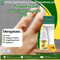Propolis SM - Untuk Mengatasi Kutil Tangan, Oles Kutil, Penghilang Kutil, Kutil di Kelopak Mata, Kut
