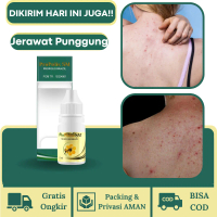 ProPolis SM Untuk Jerawat Leher Dada Jerawat Punggung dan Badan gatal kulit