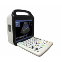 Color Doppler ultrasound diagnostic system C8 is used to diagnose peripheral blood vessels of human superficial small organs