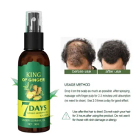 Ginger Hair Growth Spray Loss Prevention Strengthening Hair Scalp Dense-Hair Massage Scalp Repair Nourishing Liquid Hair Care