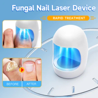 Nail Fungus Cleaning Device for Damaged Discolored Thick Toenails &amp; Fingernails Nail Fungal Infection Remedy LED Light Device