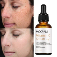 20% Vitamin C Face Serum Whitening Freckle Fade Dark Spot Removal Pigment Melanin Correcting Vitamin C Serum with Retinol