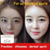 377 whitening cream VC cream freckles chloasma senile plaques beauty salons yellowing cream control cream