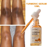 Turmeric Freckle Whitening Serum Pigment Melanin Correcting Facial Oil Control Removal Acne Smooth Brighten Skin Care Product