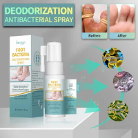 Foot Care Spray Inhibits Beriberi Deodorizes Relieves Itching Peeling Dryness Ulceration Moisturizing Healthy Skin Care 20ml