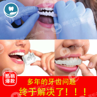 牙套吃飯神器仿真假牙套美白 矽膠 鍍膜門牙縫遮蓋蛀牙齙牙黃貼片
